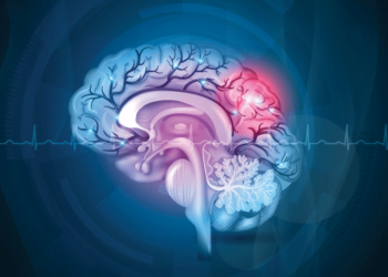 Accidentul vascular cerebral