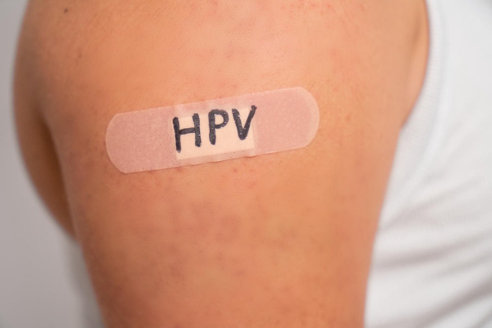 HPV la bărbați